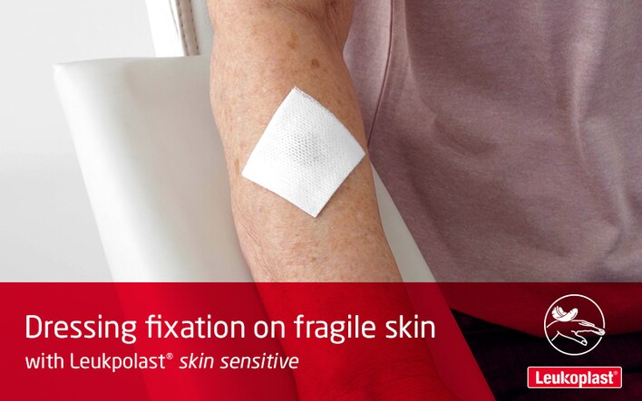 Her ser vi, hvordan en sårbandage påsættes og justeres på særdeles sensitiv hud med medicinsk tape: En sundhedsperson fastgør en sårpude på en ældre kvindes underarm med skrøbelig hud ved hjælp af Leukoplast skin sensitive.